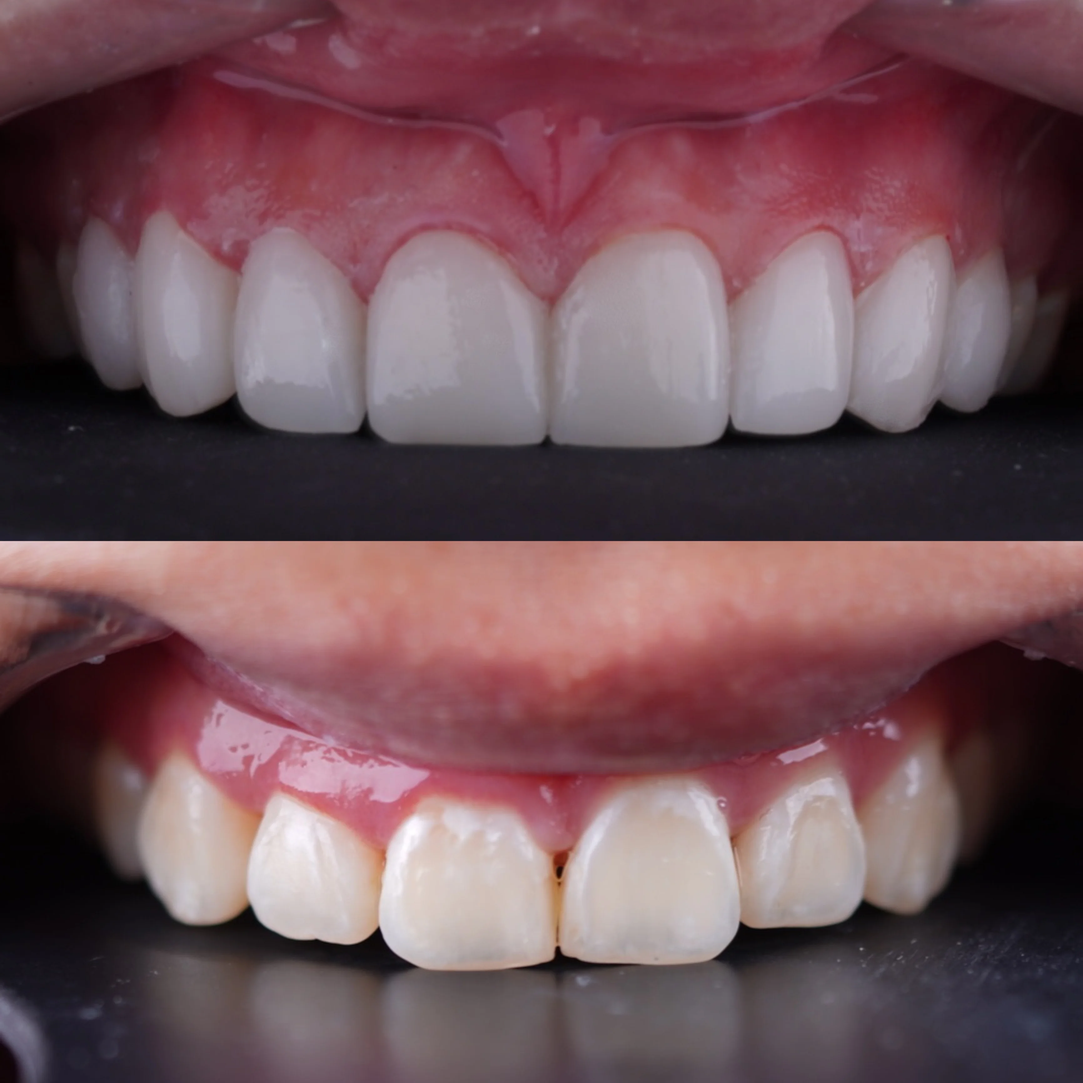 Smile Result Case 3